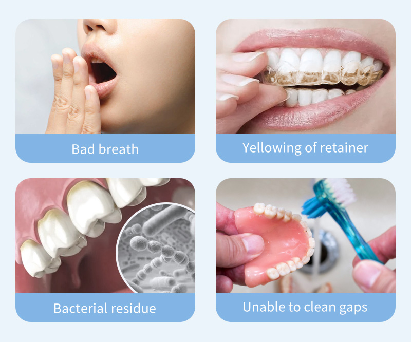 problems-encountered-in-cleaning-retainers