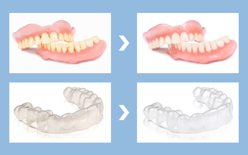 before-and-after-comparison-of-cleaning-braces-with-skymen-dental-ultrasonic-cleaning-machine